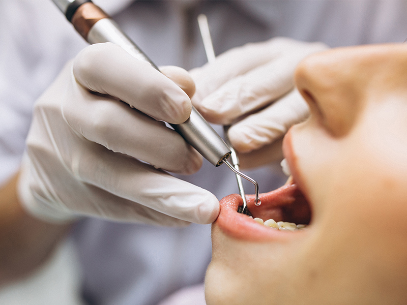 Malatya İmplant Diş Fiyatları 2022