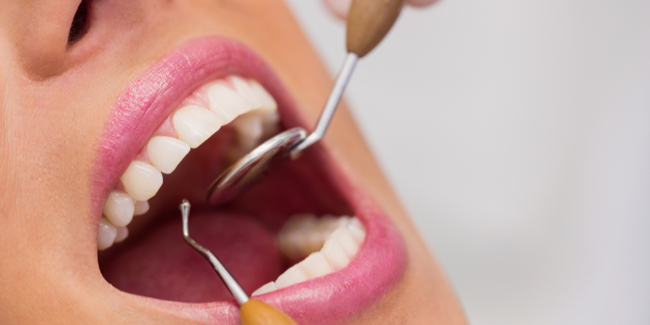 Diş Protezi Nedir?